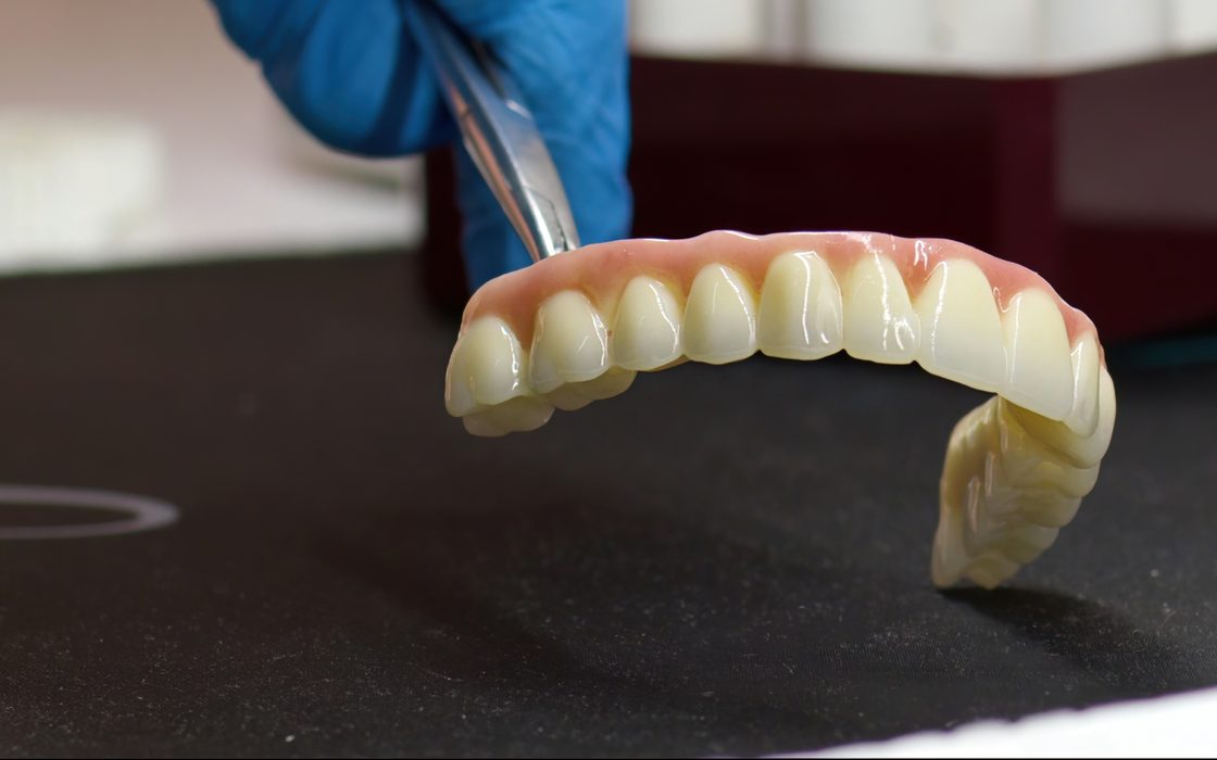 Una protesi dentale totale superiore rifinita, sostenuta con una pinza sul piano di lavoro